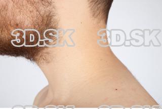 Neck texture of Charlie 0004